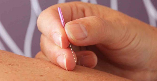 Uit balans?  Acupunctuur helpt