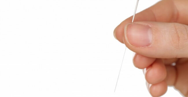 Acupunctuur en Chinese geneeswijze