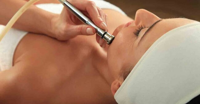 Microdermabrasie voor een frisse huid