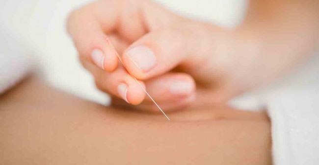 Acupunctuur  bij hormonale problemen