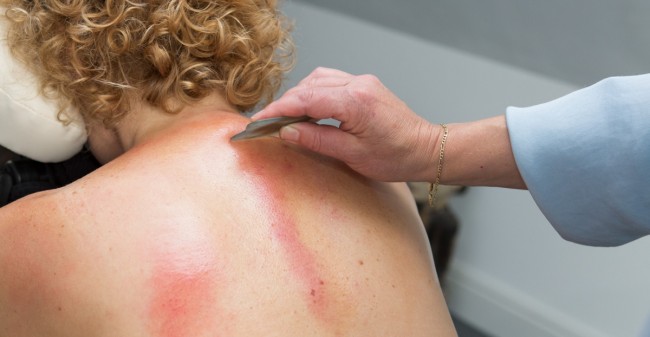 Afvalstoffen kwijtraken met Santai Guasha