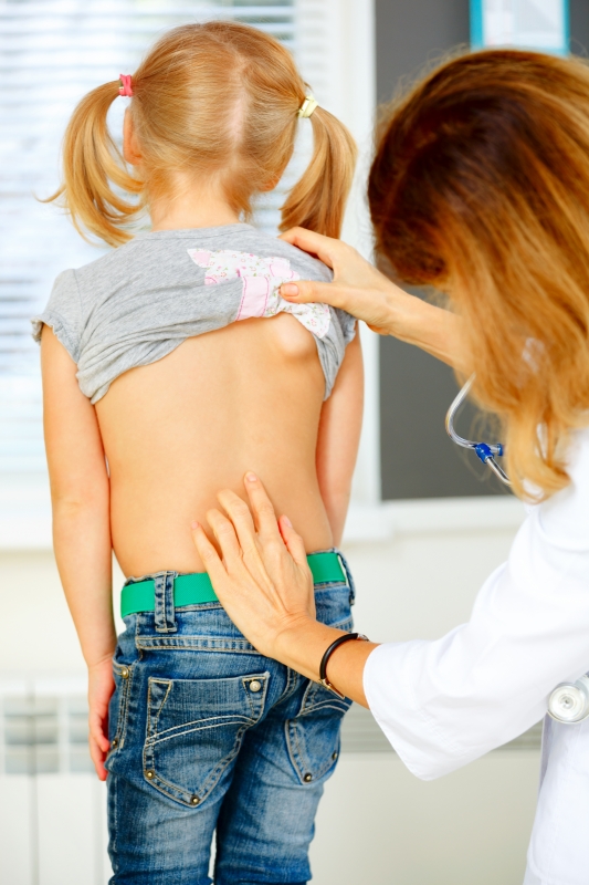 Oefentherapie voor kinderen met scoliose