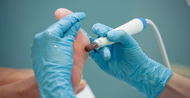 De juiste zorg voor jouw voeten