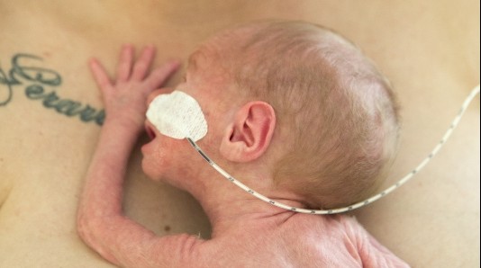 Zorg voor te vroeg geboren kinderen
