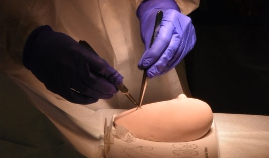 Tumoren markeren met een jodiumzaadje