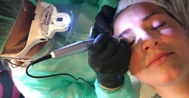 permanente make-up verwijderen zonder laser