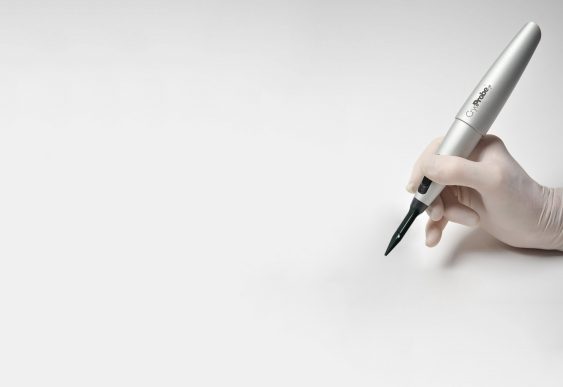 Pigmentvlekken weg in slechts enkele seconden