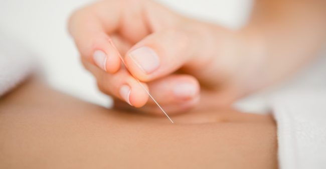 ‘Dry needling zinvolle methode bij pijn vanuit spieren’
