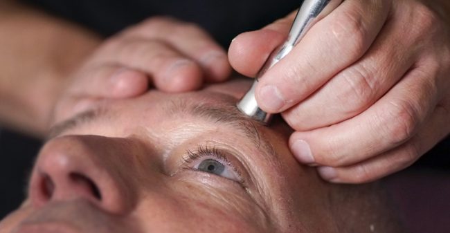 Stralend de zomer in met microdermabrasie