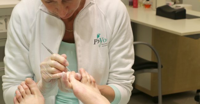 De risico’s van slippers