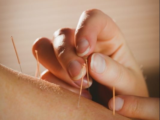 Stress? Laat je prikken!