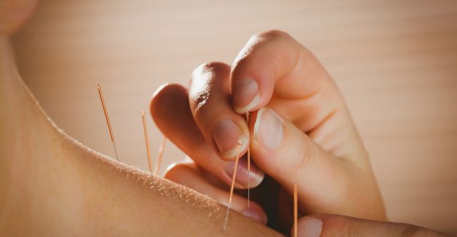 Acupunctuur en behandeling bij kanker