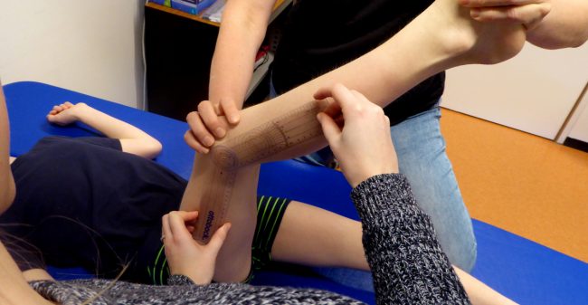‘We leren kinderen beter met hun aandoening omgaan’
