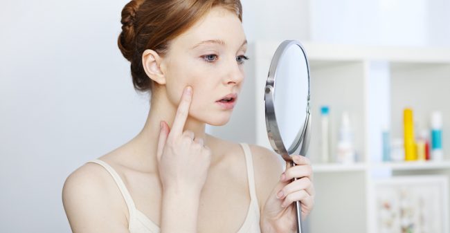 ‘Ik stoorde me enorm aan mijn acne’