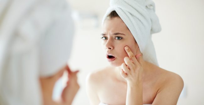 Eerste hulp bij acne!