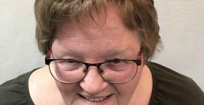 ‘Mijn haargrens week steeds verder terug’