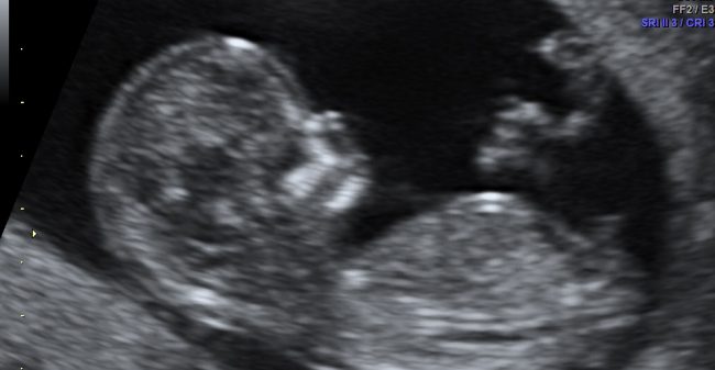 Jullie kleine wonder in beeld