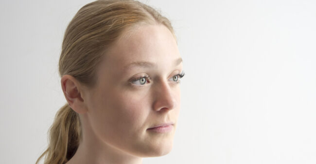 Huidverbetering zonder botox? Ja hoor!