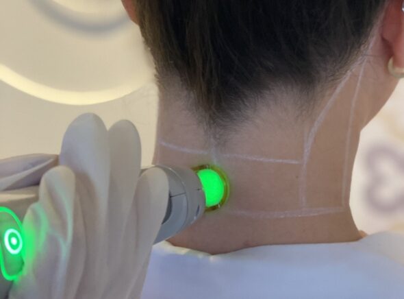 Feiten en fabels over laserontharing