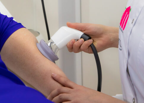 Wij zien mooie resultaten met cupping