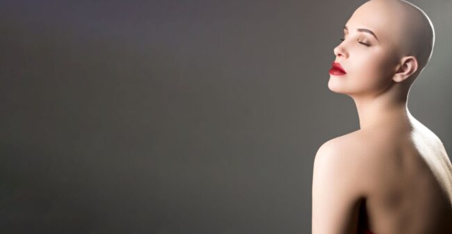 PMU: ook uitkomst bij alopecia